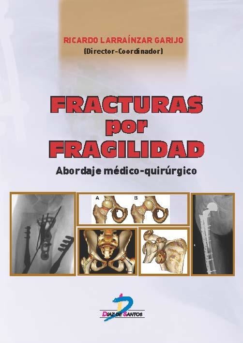 FRACTURAS POR FRAGILIDAD. ABORDAJE MÉDICO QUIRÚRGICO | 9788490520949 | LARRAÍNZAR GARIJO, RICARDO